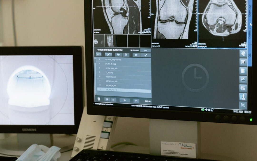 TÉCNICO ESPECIALISTA DE RADIODIAGNÓSTICO